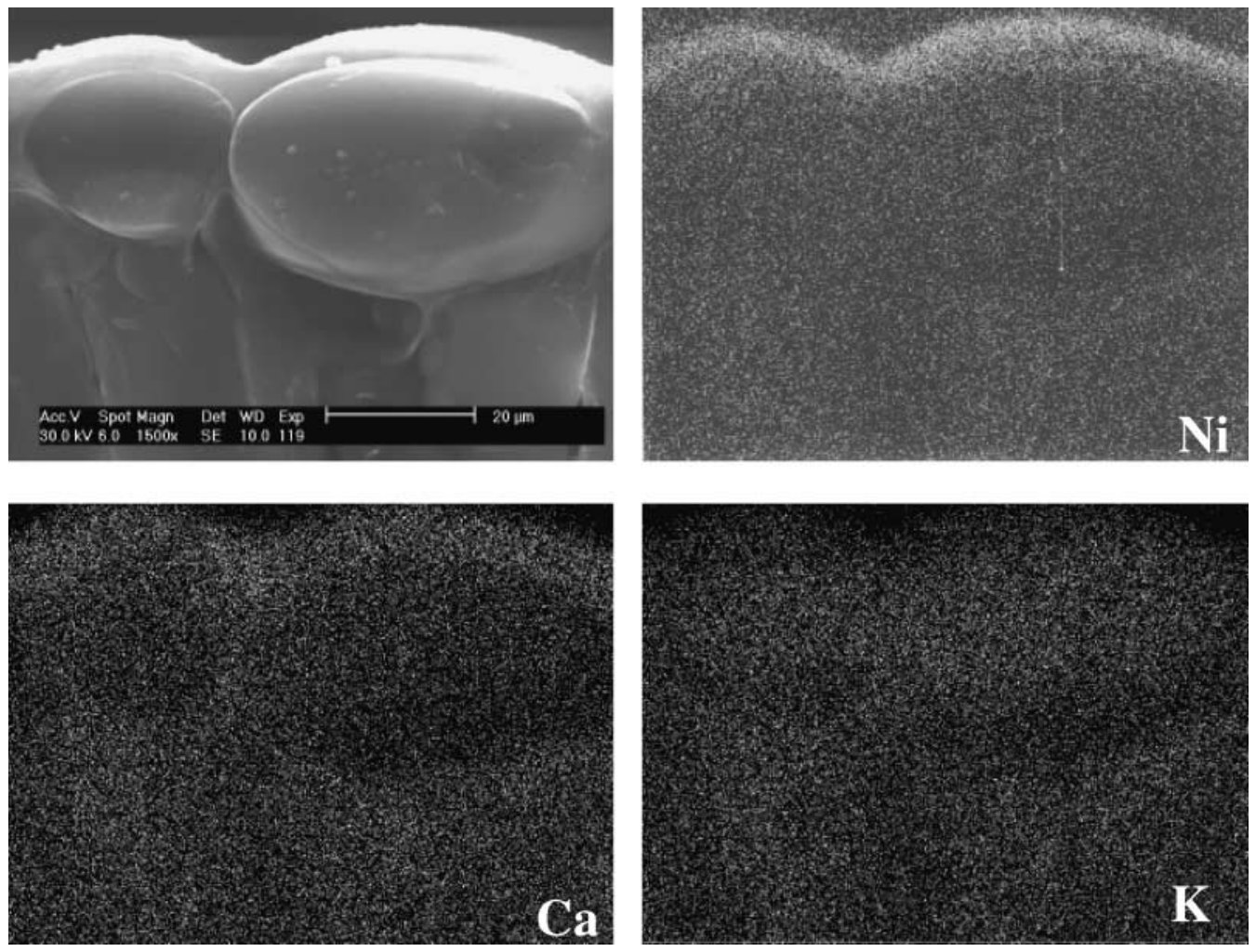 Fig. 4 Distribution of nickel (Ni), calcium (Ca) and potassium (K) across upper cuticle, upper epidermis cells and palisade of Berkheya coddii leaf, as revealed by X-ray microanalyses of frozen-hydrated tissues.